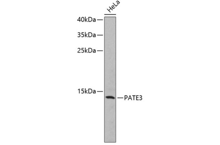 Western Blot - Anti-PATE3 Antibody (A2204) - Antibodies.com