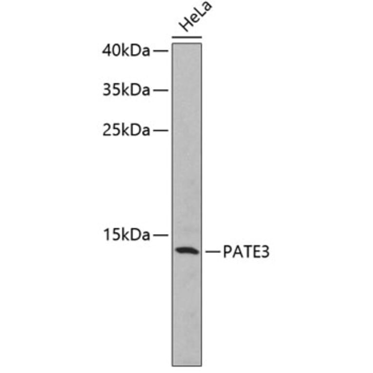 Western Blot - Anti-PATE3 Antibody (A2204) - Antibodies.com