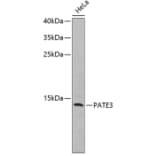 Western Blot - Anti-PATE3 Antibody (A2204) - Antibodies.com