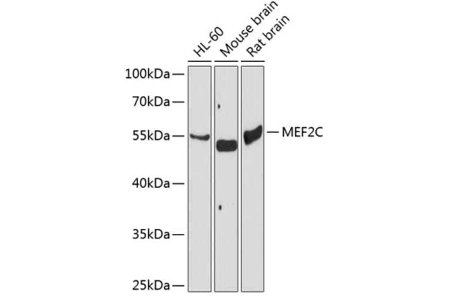 Western Blot - Anti-MEF2C Antibody (A2205) - Antibodies.com