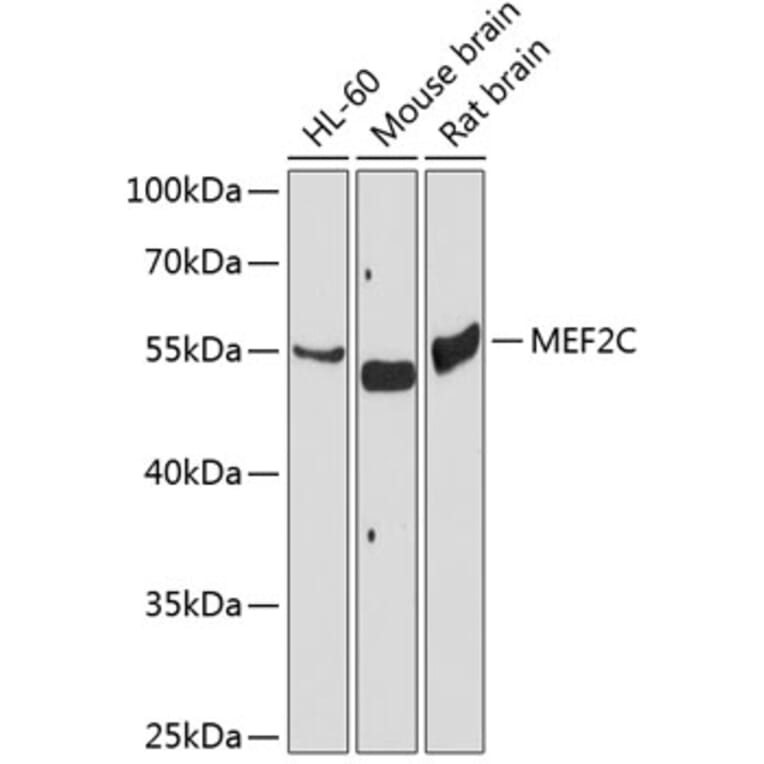 Western Blot - Anti-MEF2C Antibody (A2205) - Antibodies.com