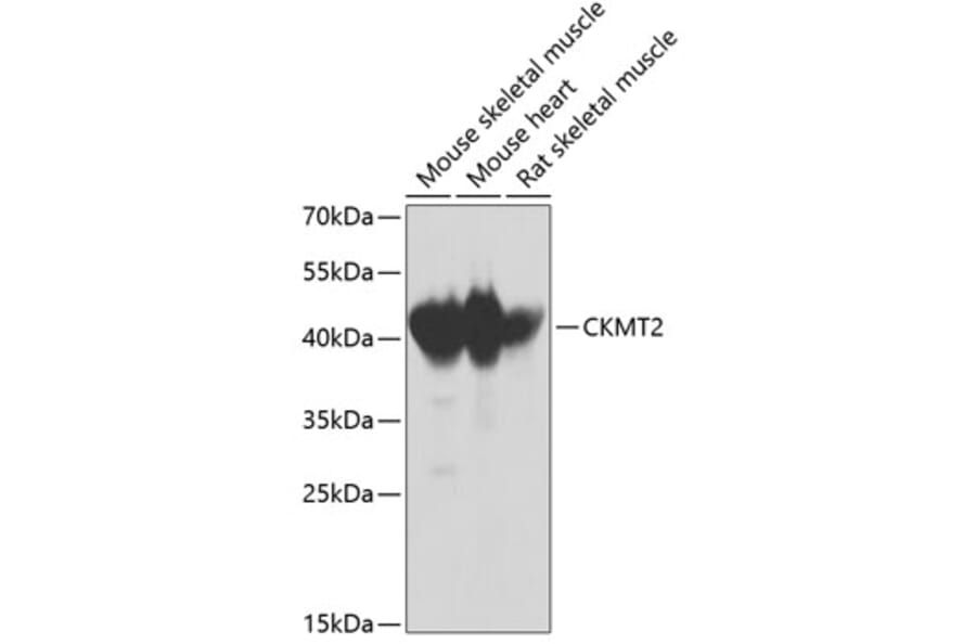 Western Blot - Anti-CKMT2 Antibody (A2206) - Antibodies.com