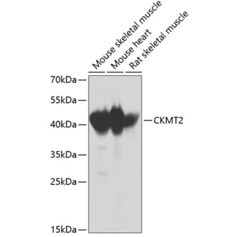 Western Blot - Anti-CKMT2 Antibody (A2206) - Antibodies.com