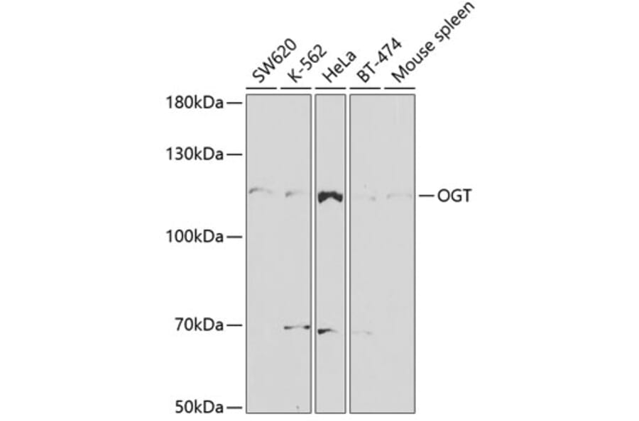 Western Blot - Anti-OGT / O-Linked N-Acetylglucosamine Transferase Antibody (A13960) - Antibodies.com