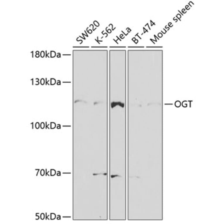 Western Blot - Anti-OGT / O-Linked N-Acetylglucosamine Transferase Antibody (A13960) - Antibodies.com