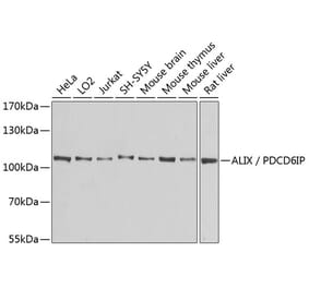 Western Blot - Anti-ALIX Antibody (A13961) - Antibodies.com