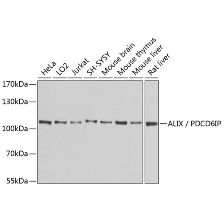 Western Blot - Anti-ALIX Antibody (A13961) - Antibodies.com