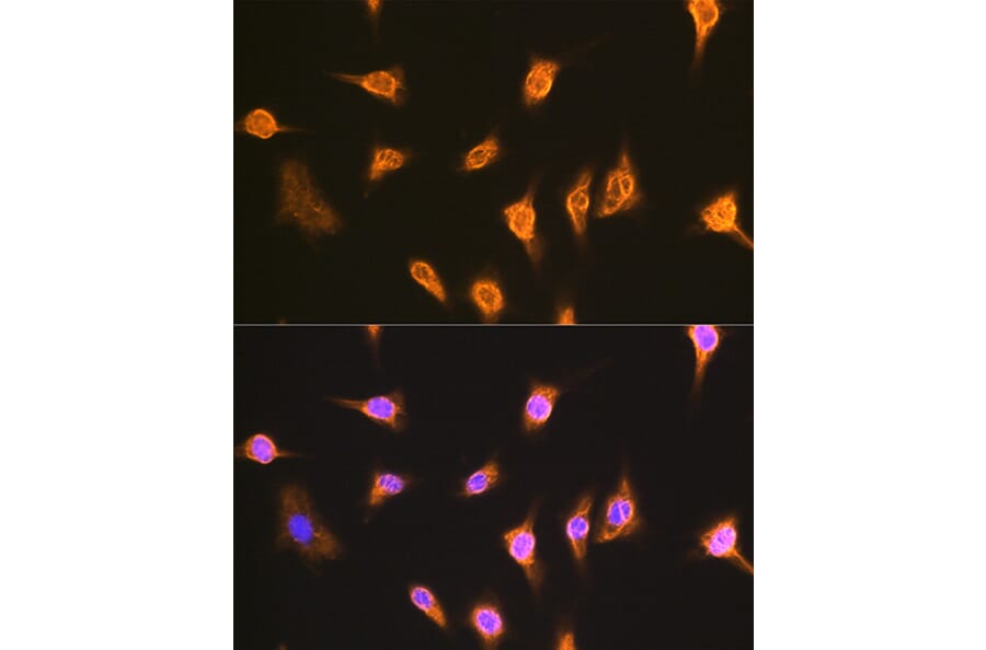 Immunofluorescence - Anti-ALIX Antibody (A13961) - Antibodies.com
