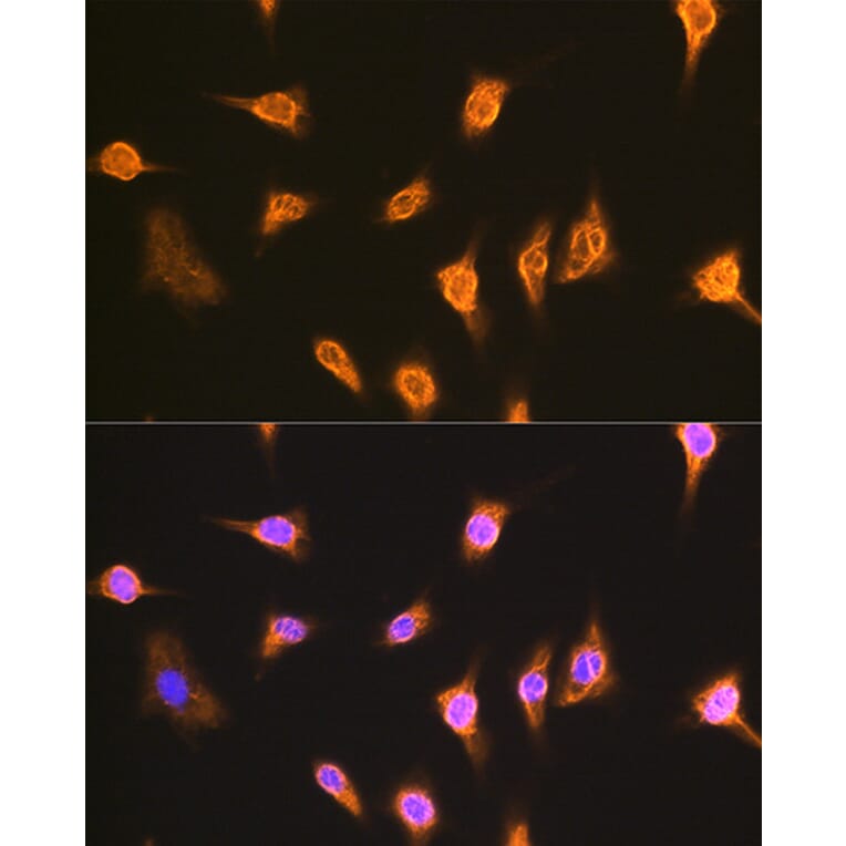 Immunofluorescence - Anti-ALIX Antibody (A13961) - Antibodies.com