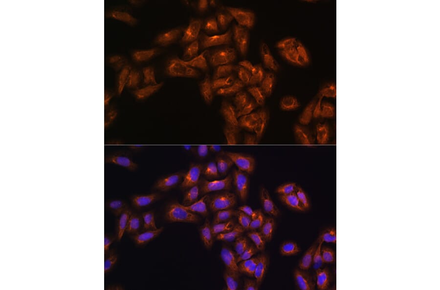 Immunofluorescence - Anti-ALIX Antibody (A13961) - Antibodies.com