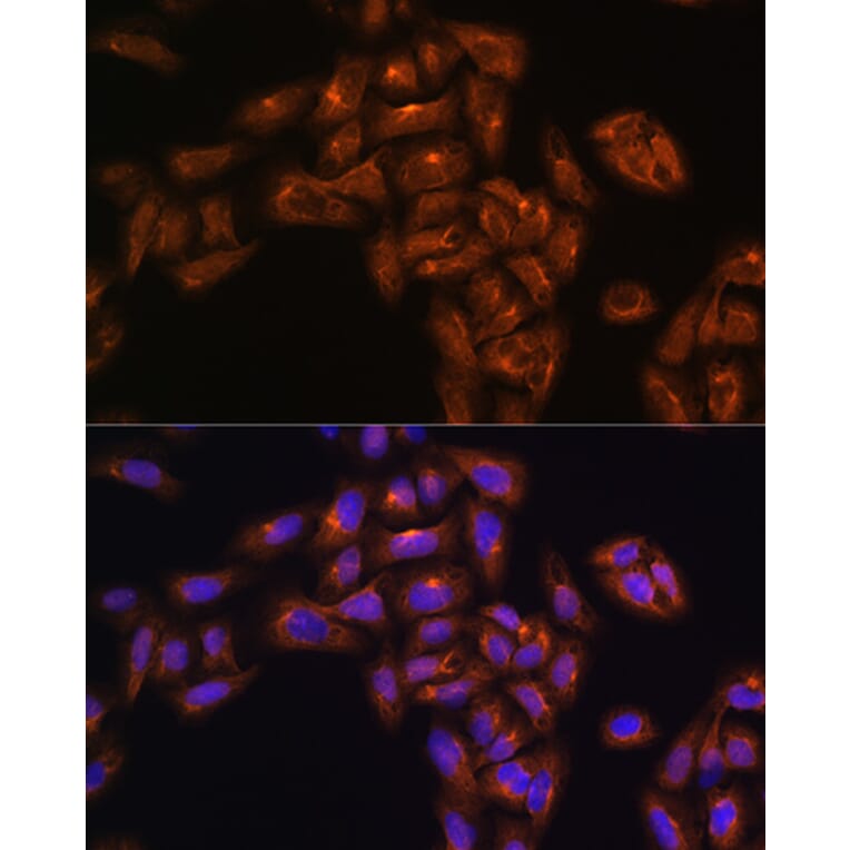 Immunofluorescence - Anti-ALIX Antibody (A13961) - Antibodies.com