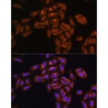 Immunofluorescence - Anti-ALIX Antibody (A13961) - Antibodies.com