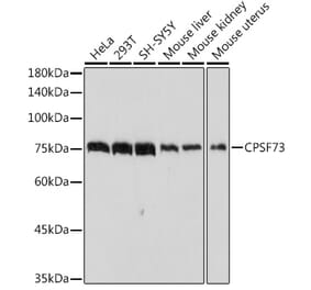 Western Blot - Anti-CPSF73 Antibody (A13963) - Antibodies.com