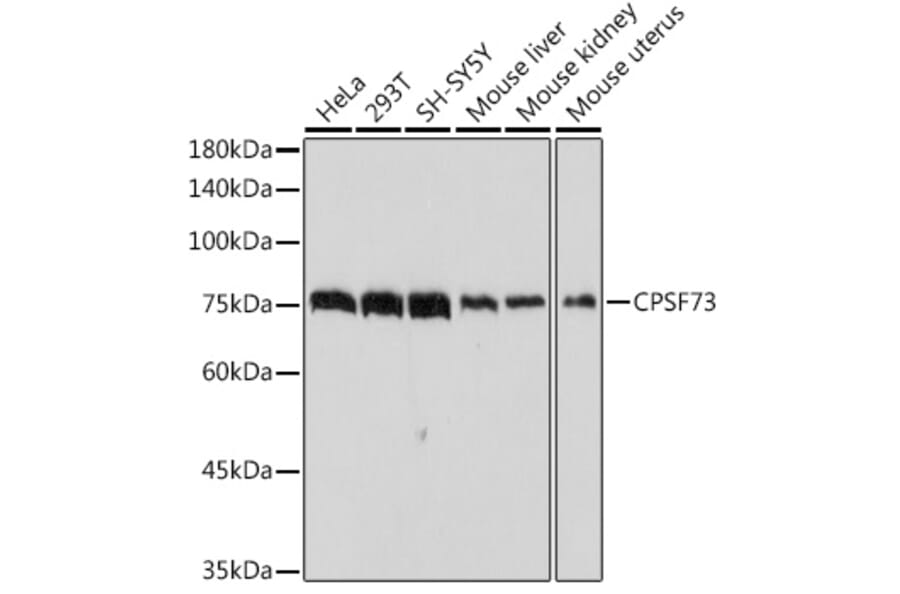 Western Blot - Anti-CPSF73 Antibody [ARC2567] (A13963) - Antibodies.com
