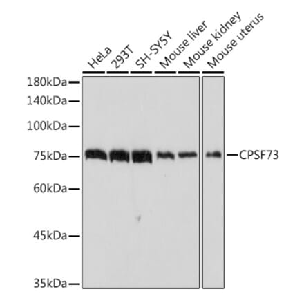 Western Blot - Anti-CPSF73 Antibody [ARC2567] (A13963) - Antibodies.com