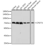 Western Blot - Anti-CPSF73 Antibody [ARC2567] (A13963) - Antibodies.com