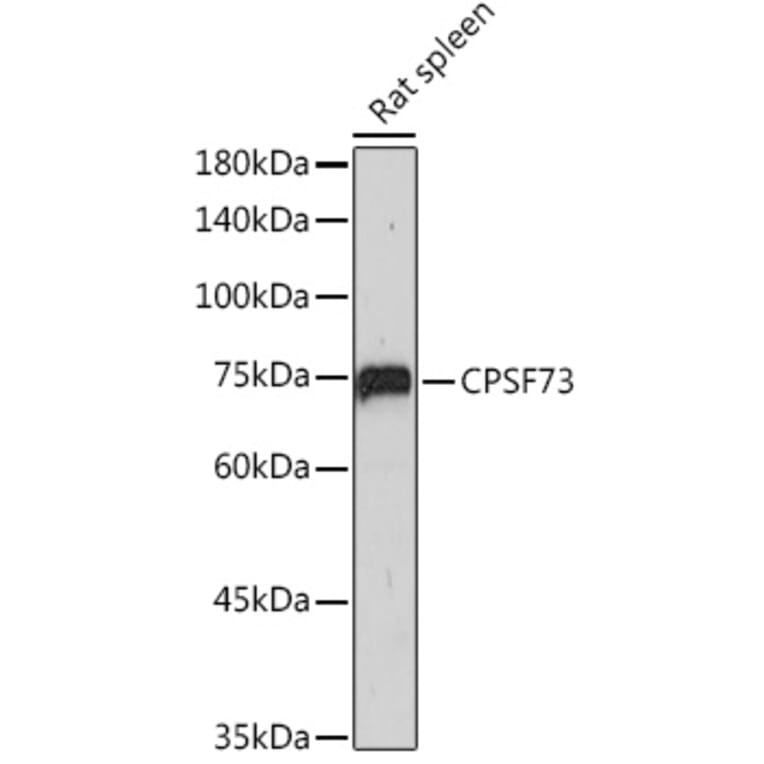 Western Blot - Anti-CPSF73 Antibody [ARC2567] (A13963) - Antibodies.com
