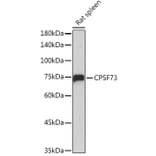 Western Blot - Anti-CPSF73 Antibody [ARC2567] (A13963) - Antibodies.com
