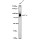 Western Blot - Anti-KAT2A/GCN5 Antibody (A13964) - Antibodies.com