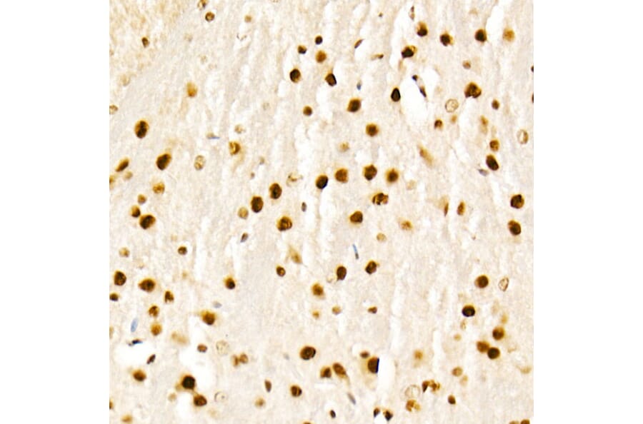 Immunohistochemistry - Anti-KAT2A/GCN5 Antibody (A13964) - Antibodies.com