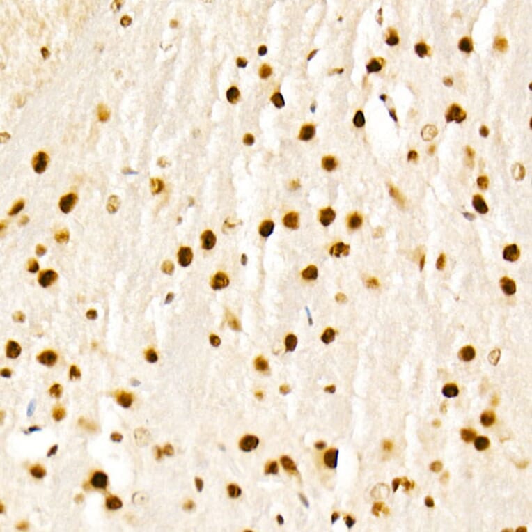 Immunohistochemistry - Anti-KAT2A/GCN5 Antibody (A13964) - Antibodies.com