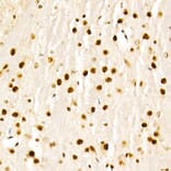 Immunohistochemistry - Anti-KAT2A/GCN5 Antibody (A13964) - Antibodies.com