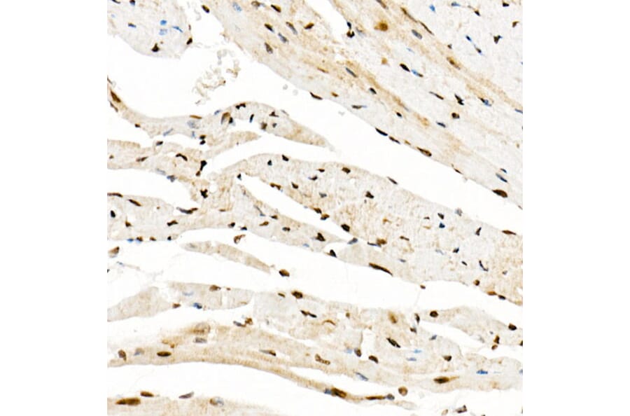Immunohistochemistry - Anti-KAT2A/GCN5 Antibody (A13964) - Antibodies.com