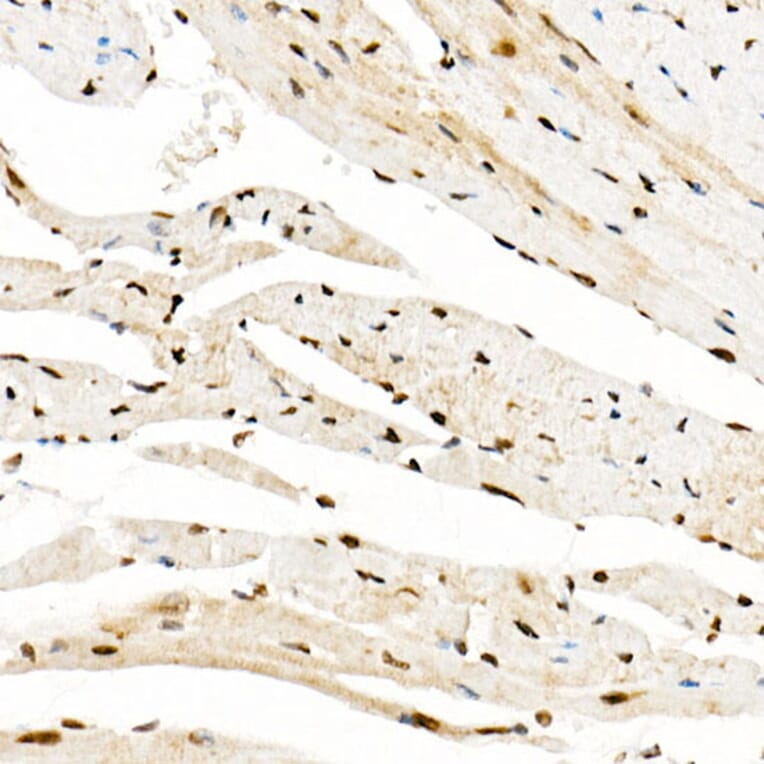 Immunohistochemistry - Anti-KAT2A/GCN5 Antibody (A13964) - Antibodies.com
