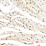 Immunohistochemistry - Anti-KAT2A/GCN5 Antibody (A13964) - Antibodies.com