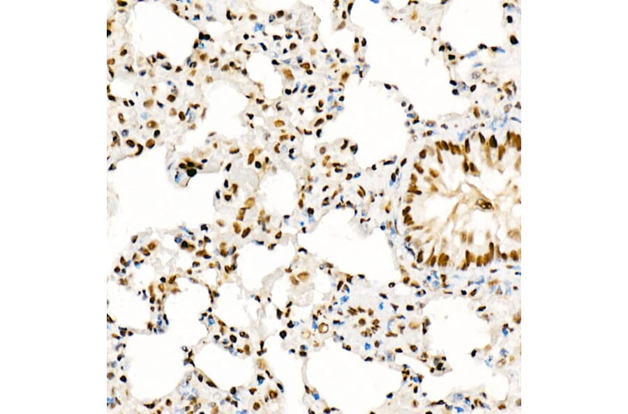 Immunohistochemistry - Anti-KAT2A/GCN5 Antibody (A13964) - Antibodies.com
