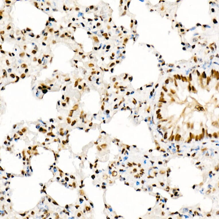 Immunohistochemistry - Anti-KAT2A/GCN5 Antibody (A13964) - Antibodies.com
