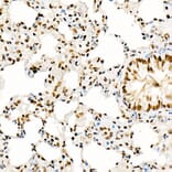 Immunohistochemistry - Anti-KAT2A/GCN5 Antibody (A13964) - Antibodies.com