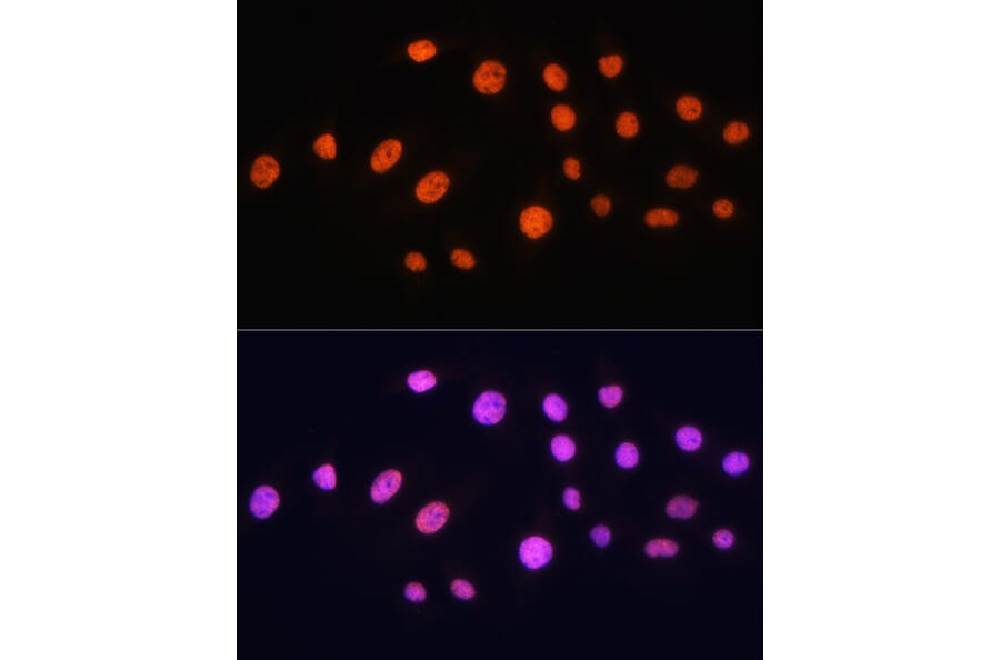 Immunofluorescence - Anti-KAT2A/GCN5 Antibody (A13964) - Antibodies.com