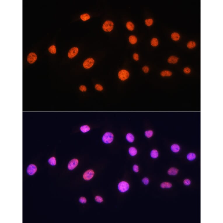 Immunofluorescence - Anti-KAT2A/GCN5 Antibody (A13964) - Antibodies.com