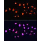 Immunofluorescence - Anti-KAT2A/GCN5 Antibody (A13964) - Antibodies.com