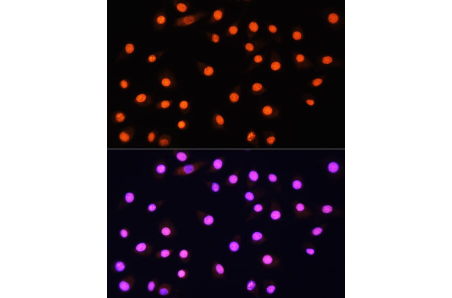 Immunofluorescence - Anti-KAT2A/GCN5 Antibody (A13964) - Antibodies.com