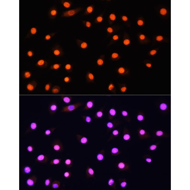 Immunofluorescence - Anti-KAT2A/GCN5 Antibody (A13964) - Antibodies.com