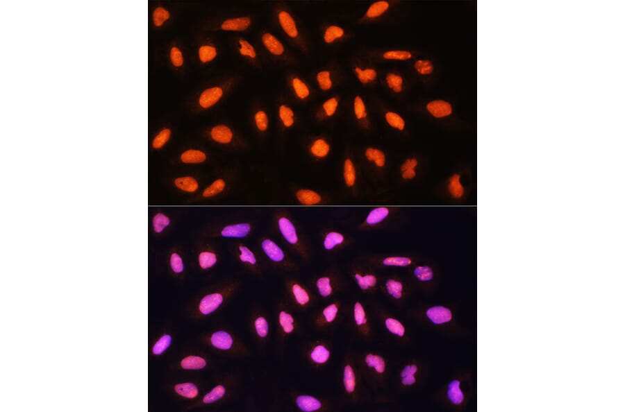 Immunofluorescence - Anti-KAT2A/GCN5 Antibody (A13964) - Antibodies.com