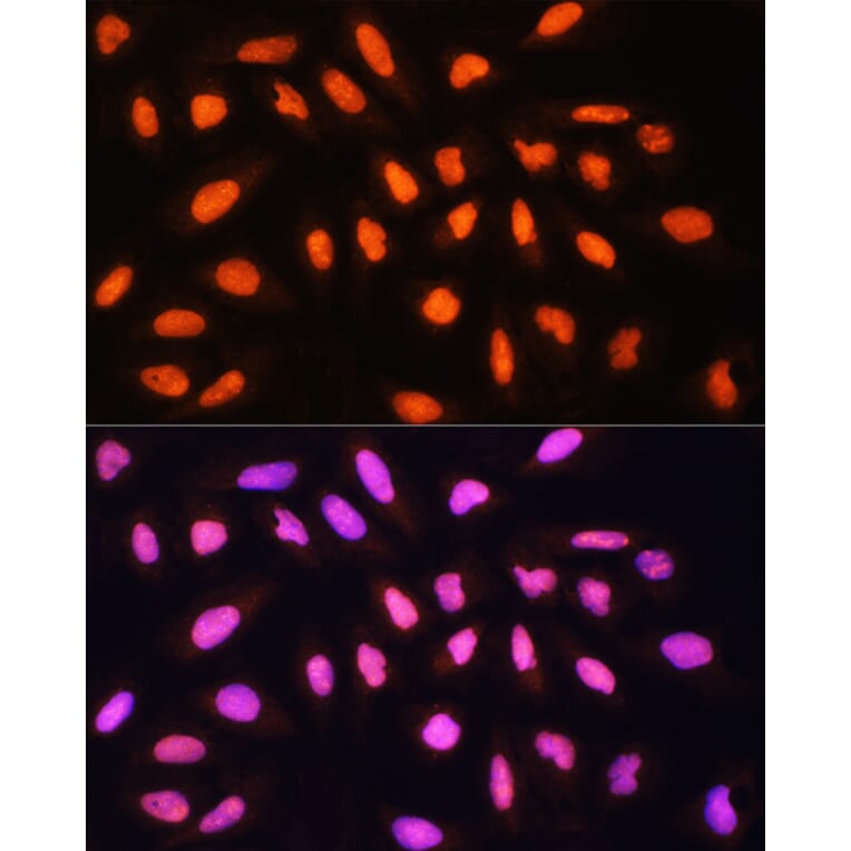 Immunofluorescence - Anti-KAT2A/GCN5 Antibody (A13964) - Antibodies.com