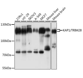Western Blot - Anti-KAP1 Antibody (A13965) - Antibodies.com