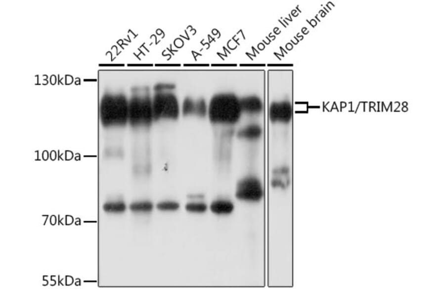 Western Blot - Anti-KAP1 Antibody (A13965) - Antibodies.com