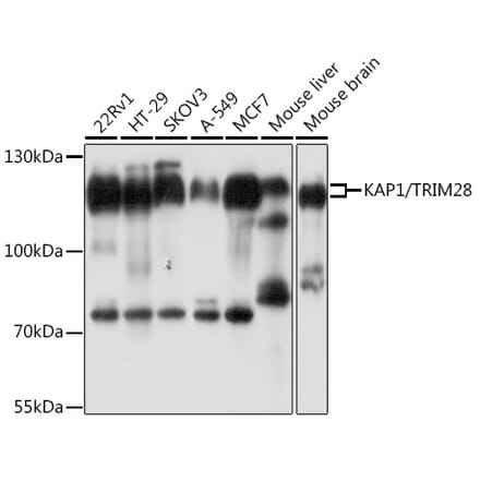 Western Blot - Anti-KAP1 Antibody (A13965) - Antibodies.com