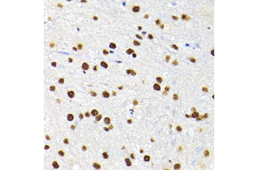 Immunohistochemistry - Anti-KAP1 Antibody (A13965) - Antibodies.com