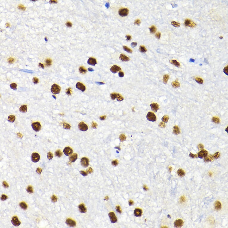 Immunohistochemistry - Anti-KAP1 Antibody (A13965) - Antibodies.com