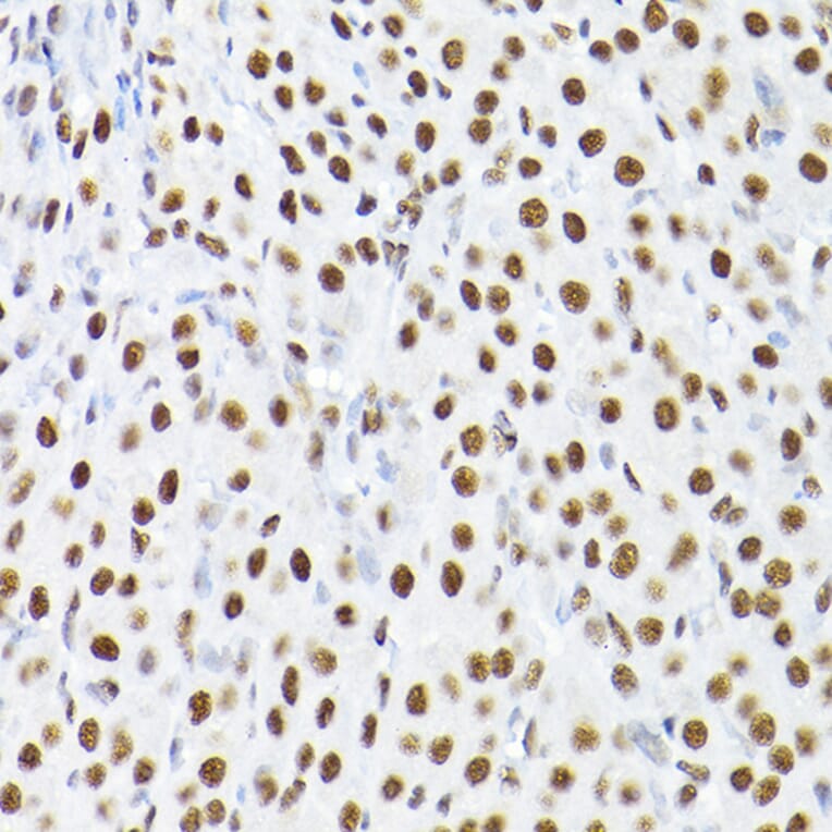 Immunohistochemistry - Anti-KAP1 Antibody (A13965) - Antibodies.com