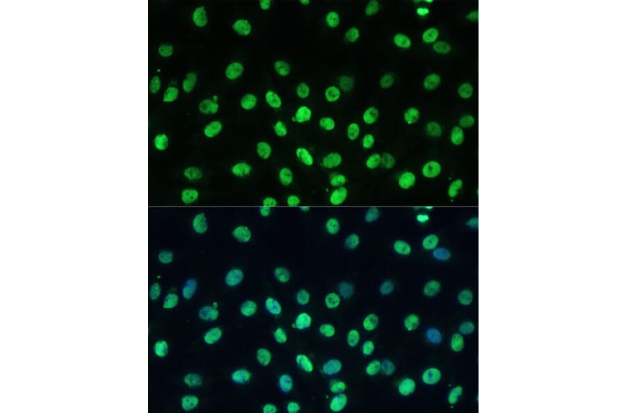 Immunofluorescence - Anti-KAP1 Antibody (A13965) - Antibodies.com