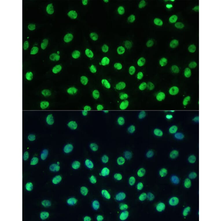 Immunofluorescence - Anti-KAP1 Antibody (A13965) - Antibodies.com