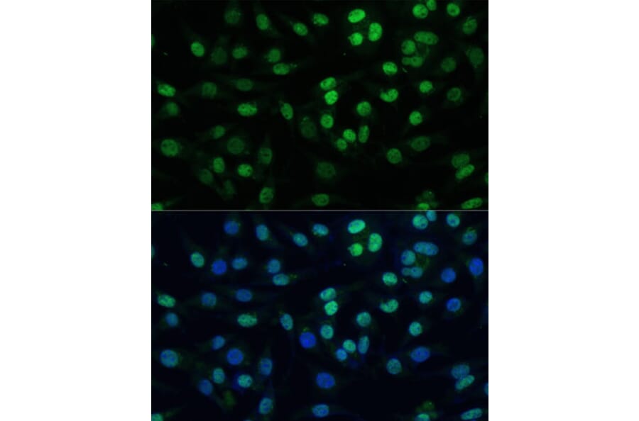 Immunofluorescence - Anti-KAP1 Antibody (A13965) - Antibodies.com