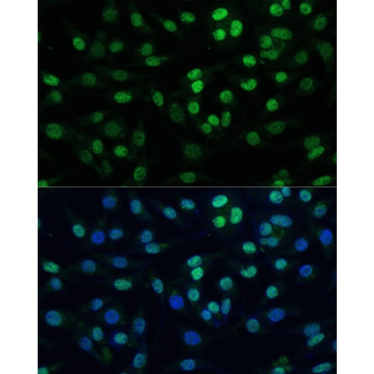 Immunofluorescence - Anti-KAP1 Antibody (A13965) - Antibodies.com