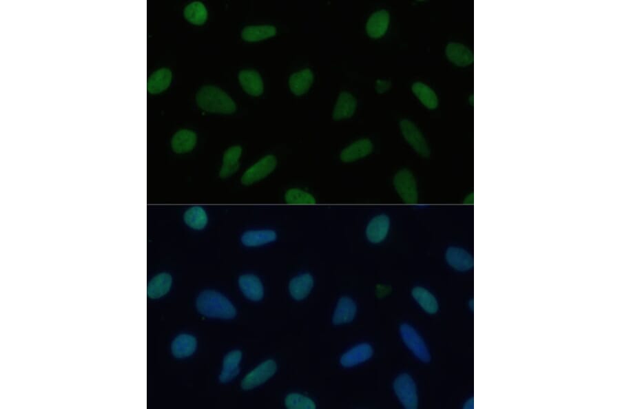 Immunofluorescence - Anti-KAP1 Antibody (A13965) - Antibodies.com